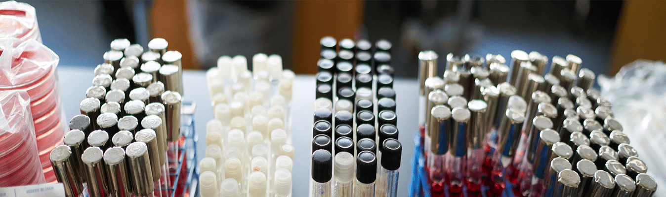 Rows of test tubes in a lab